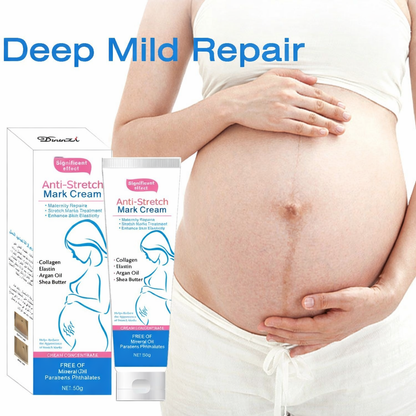 Stretch Mark Prevention Cream
