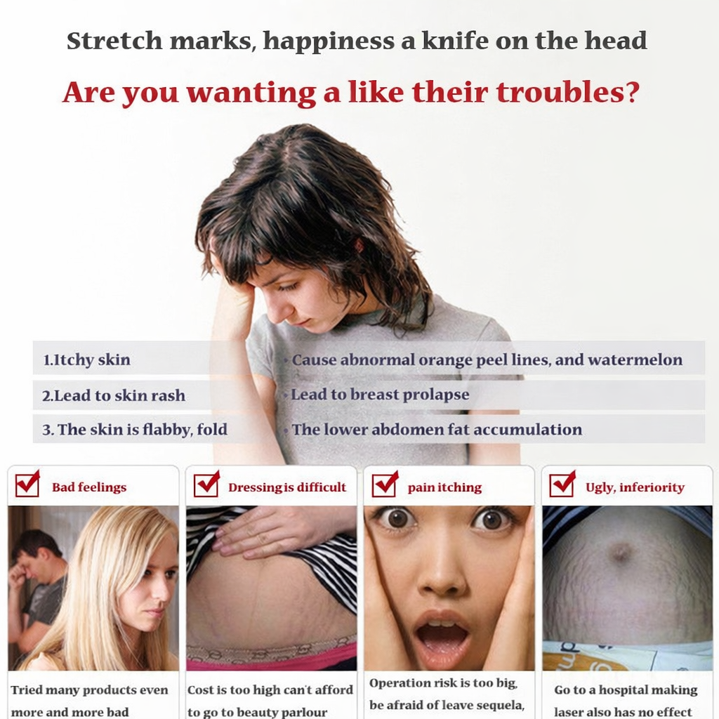 Stretch Mark Prevention Cream