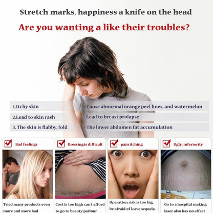 Stretch Mark Prevention Cream